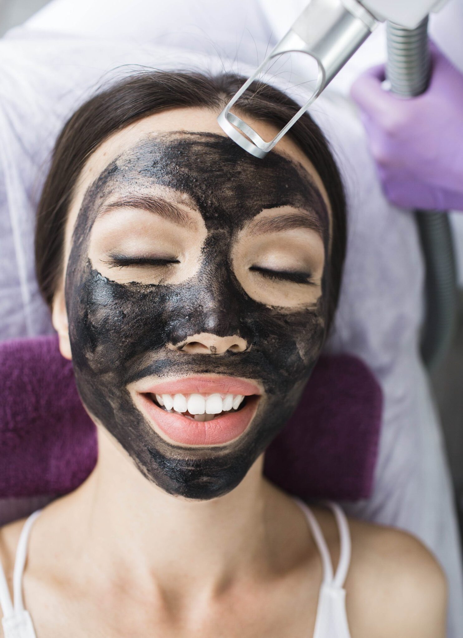 Carbon Laser Peel
